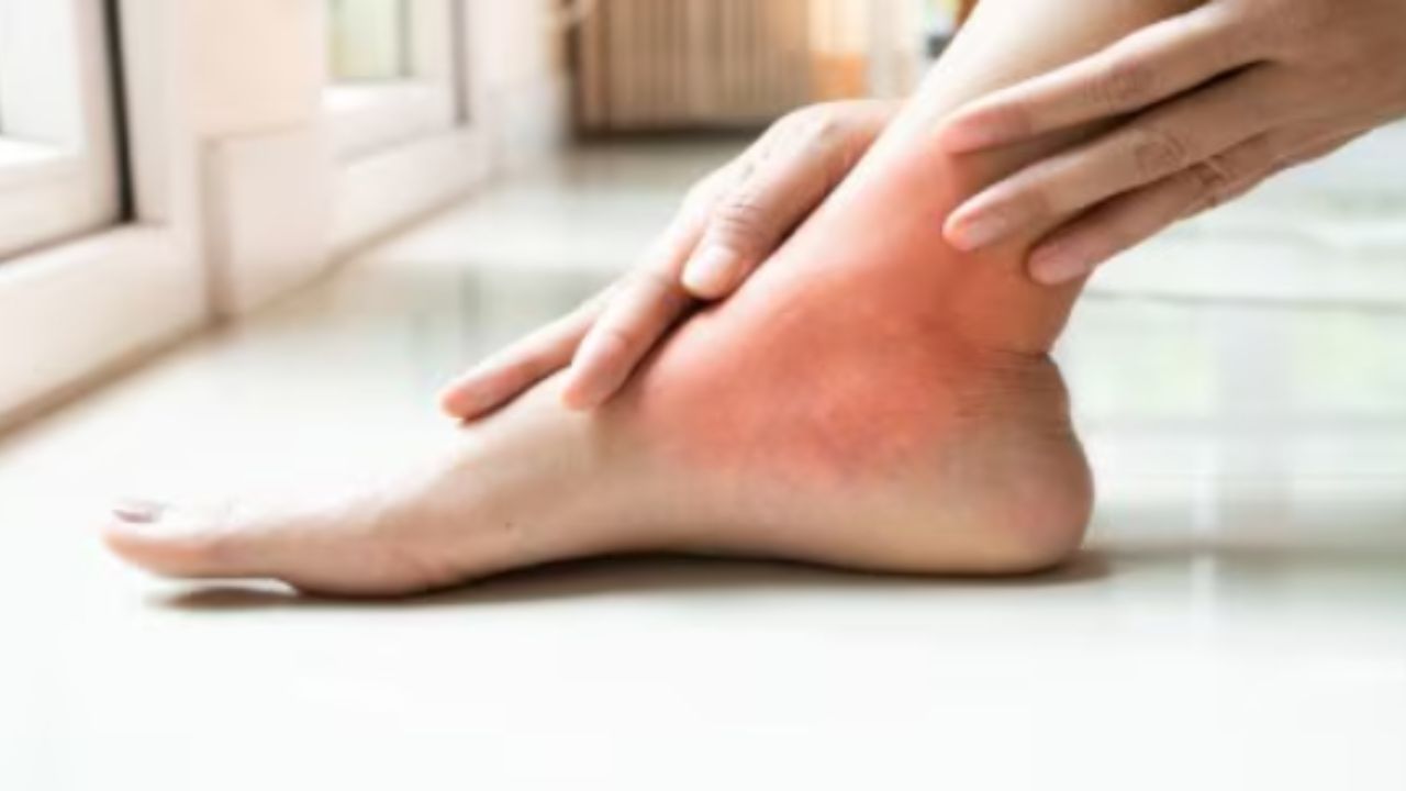 Uric acid pain: यूरिक एसिड का दर्द सबसे पहले शरीर के इस हिस्से में होता है, ऐसे करें पहचान