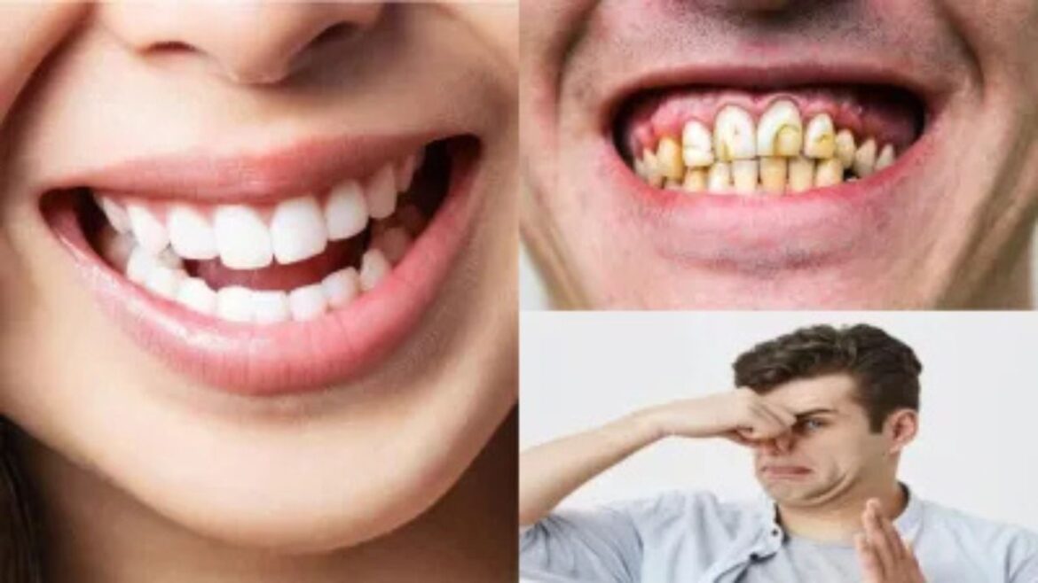 World Oral Health Day: दांतों की सफेदी के लिए रोज़ाना अपनाएं ये ओरल केयर टिप्स World Oral Health Day: दांतों की सफेदी के लिए रोज़ाना अपनाएं ये ओरल केयर टिप्स